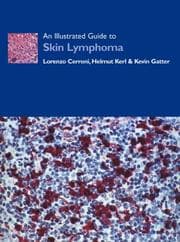 Tapa de Illustrated Guide to Skin Lymphoma Diagnosis