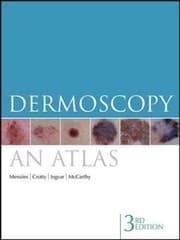 Tapa de Dermoscopy