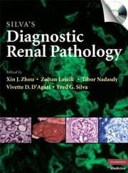 Tapa de Silva's diagnostic renal pathology