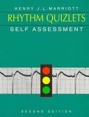 Tapa de Rhythm quizlets