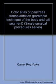 Tapa de Color atlas of pancreas transplantation (paratopic technique of the body and tail segment)