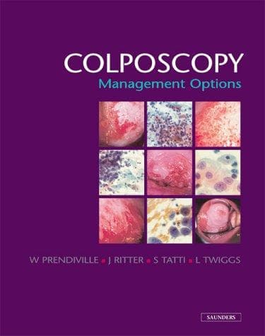 Tapa de Colposcopy