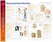 Tapa de Frank H. Netter Musculoskeletal Disorders Poster (European Netter Poster)