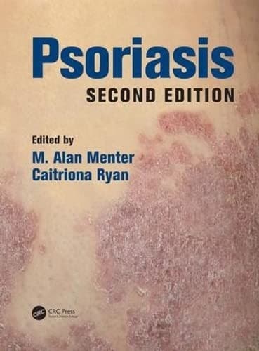 Tapa de Psoriasis