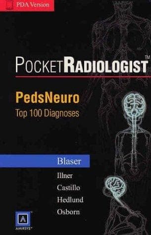 Tapa de PocketRadiologist - PedsNeuro