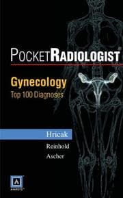 Tapa de Gynecology