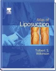 Tapa de Atlas of liposuction