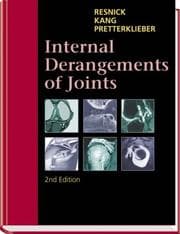 Tapa de Internal Derangements of Joints