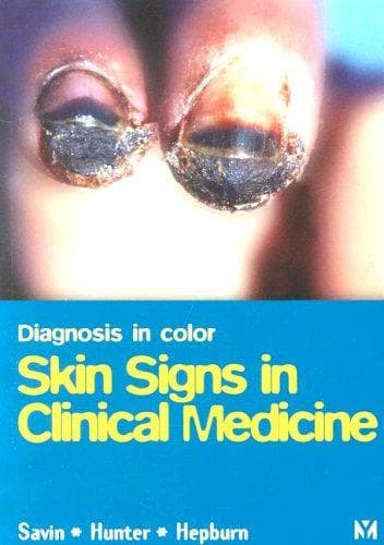 Tapa de Diagnosis in color