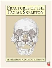Tapa de Fractures of the facial skeleton