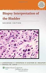Tapa de Biopsy interpretation of the bladder