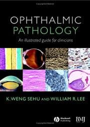 Tapa de Ophthalmic pathology