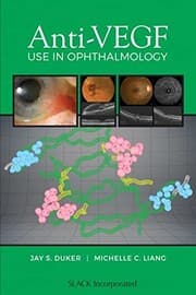 Tapa de Anti-VEGF Use in Ophthalmology