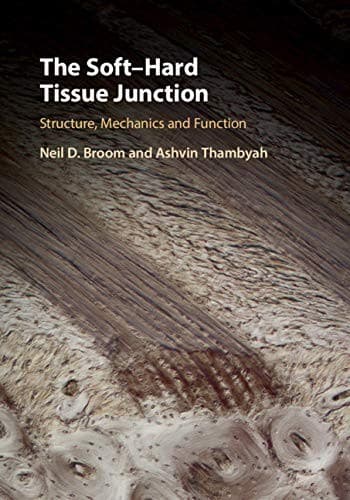 Tapa de Soft-Hard Tissue Junction