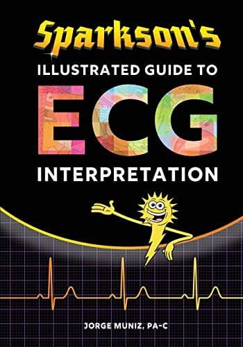 Tapa de Sparkson's Illustrated Guide to ECG Interpretation