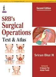 Tapa de SRB's Surgical Operations