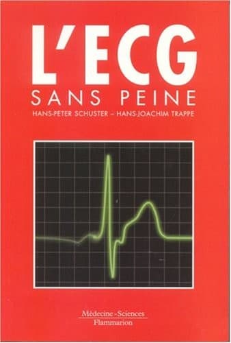 Tapa de L' ECG sans peine