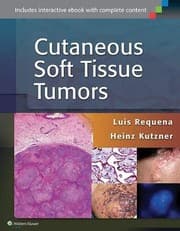 Tapa de Cutaneous Soft Tissue Tumors