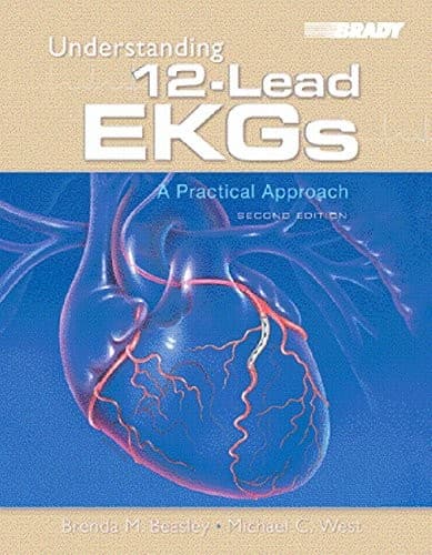 Tapa de Understanding 12-lead EKGs