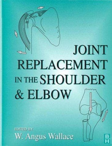 Tapa de Joint replacement in the shoulder and elbow