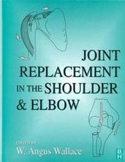 Tapa de Joint replacement in the shoulder and elbow