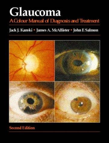 Tapa de Glaucoma