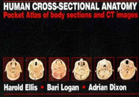 Tapa de Human cross-sectional anatomy