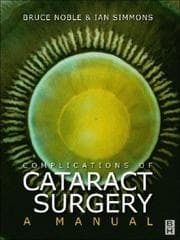 Tapa de Complications of Cataract Surgery
