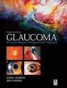 Tapa de Glaucoma