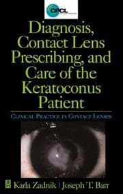Tapa de Diagnosis, contact lens prescribing, and care of the keratoconus patient