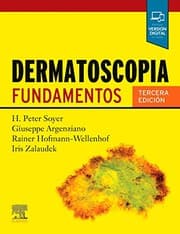 Tapa de Dermatoscopia