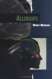 Tapa de Allergies (Twenty-First Century Medical Library)