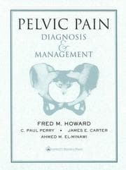 Tapa de Pelvic pain