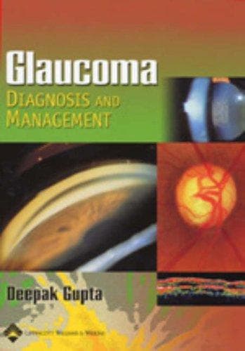 Tapa de Glaucoma Diagnosis and Management