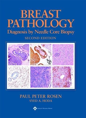 Tapa de Breast Pathology