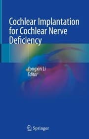 Tapa de Cochlear Implantation for Cochlear Nerve Deficiency