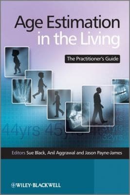 Tapa de Age estimation in the living