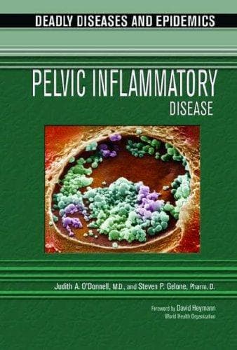 Tapa de Pelvic inflammatory disease