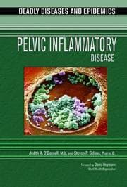 Tapa de Pelvic inflammatory disease