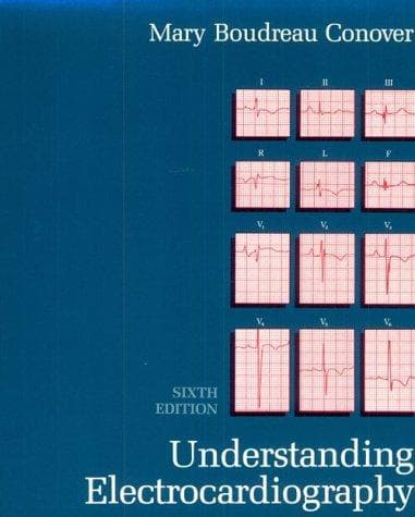 Tapa de Understanding electrocardiography