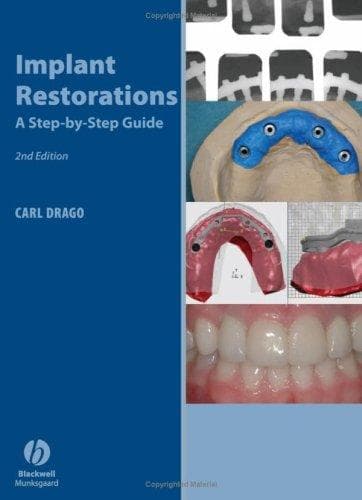 Tapa de Implant Restoration Solutions
