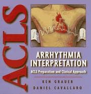 Tapa de Arrhythmia interpretation
