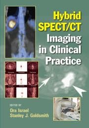 Tapa de Hybrid SPECT/CT imaging in clinical practice