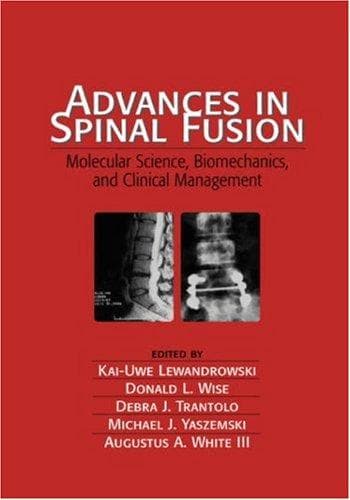 Tapa de Advances in Spinal Fusion