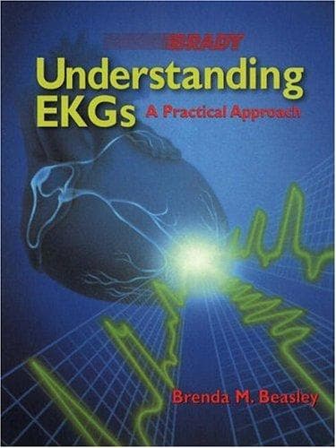 Tapa de Understanding EKGs