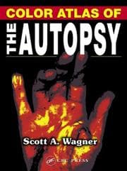 Tapa de Color atlas of the autopsy