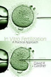 Tapa de In Vitro Fertilization