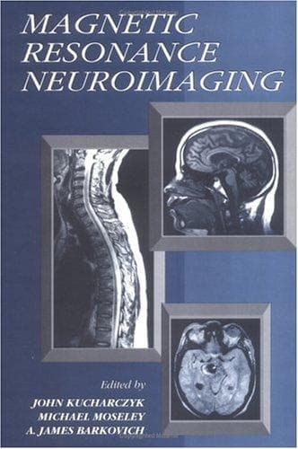 Tapa de Magnetic resonance neuroimaging
