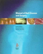 Tapa de Manual of nail disease and surgery