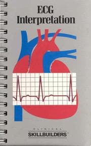 Tapa de ECG interpretation